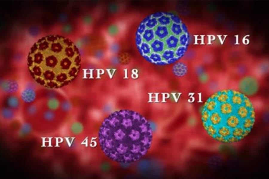 Virus HPV - tác nhân gây ung thư có thể “tấn công” bất kỳ ai