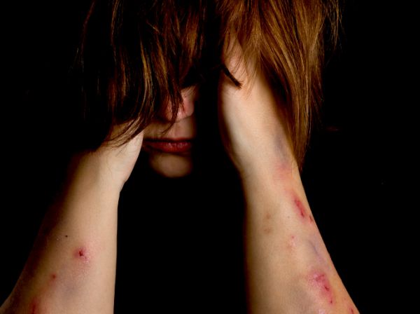 Báo động hội chứng tự ngược đãi bản thân ở thanh thiếu niên