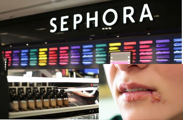 Khách hàng kiện Sephora do bị nhiễm virus herpes khi dùng thử son