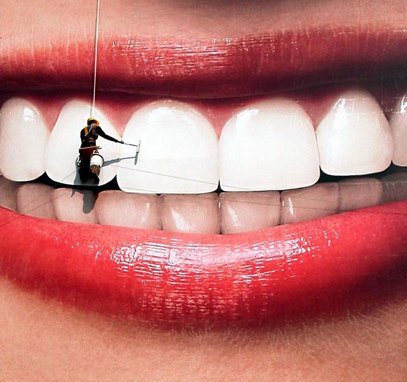 6 cách loại bỏ mảng bám cho răng trắng sáng tự nhiên