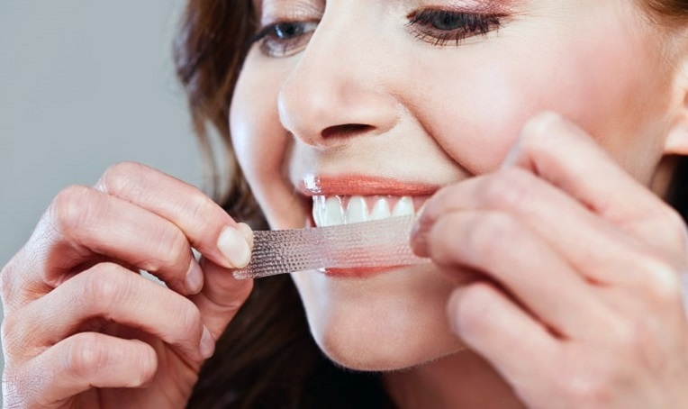 Những điều cần biết khi sử dụng miếng dán trắng răng